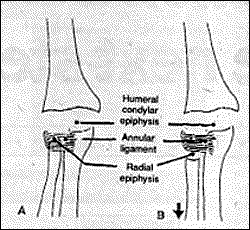 Figure 1 A&B