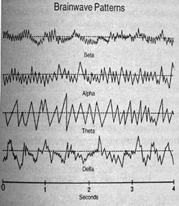 Brainwave Patterns