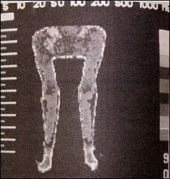 Figure 2B