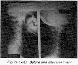 Figure 1 A/B