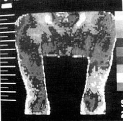 Figure 2A