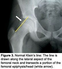 Abdominal pain without Anna Diet Loss Nicole Weight vomiting, vaginal bleeding, passing out, chest.