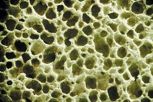 bone density