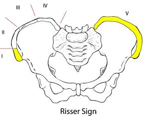 Cervical spine maturation