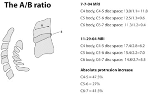 The A/B ration.