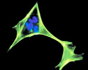 fibroblast cell