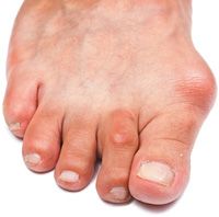 gout