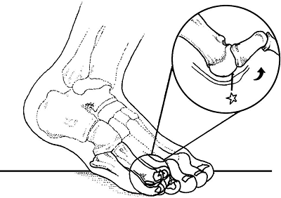 dorsiflexion