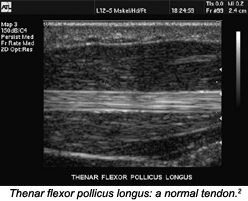 elbow ultrasound