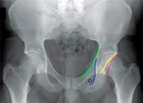 normal pelvis