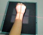 PA wrist