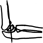 anterior humeral line