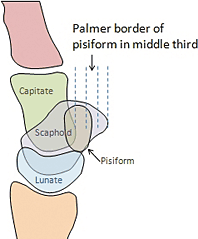 pisiform