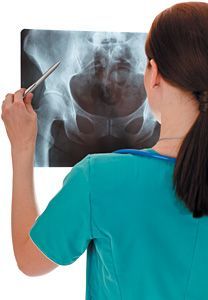 reviewing x-ray