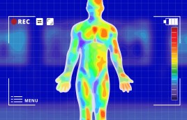 Musculoskeletal Thermography