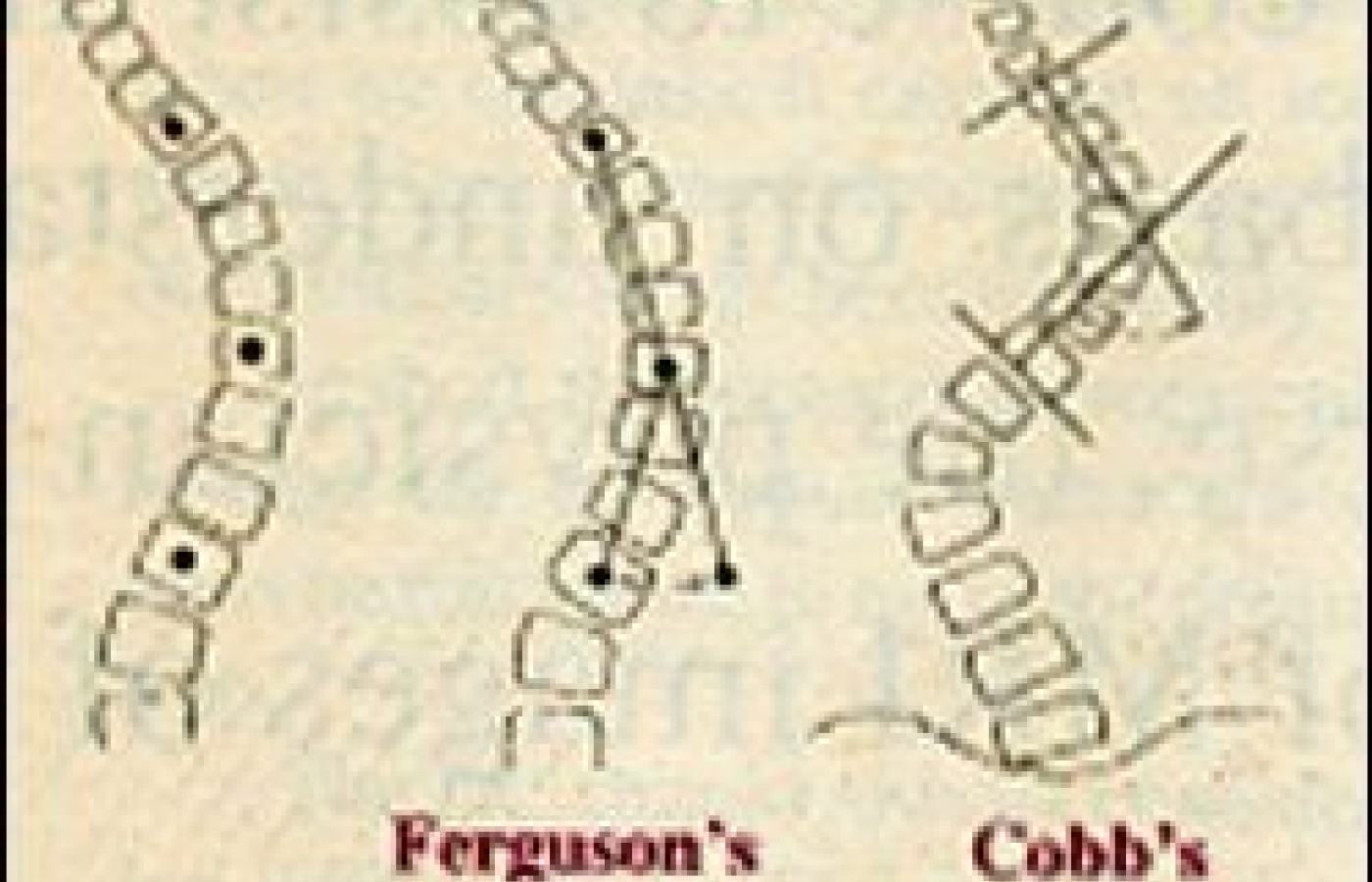 Ferguson vs. Cobb Methods